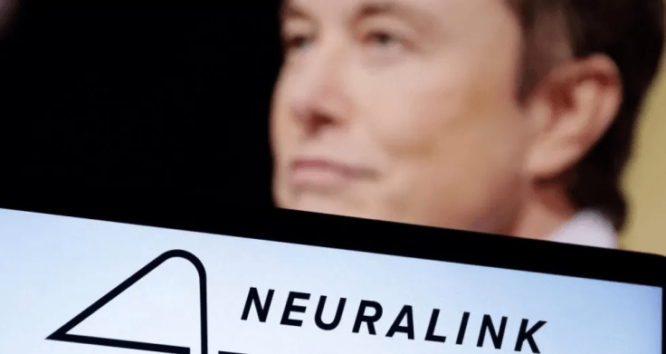 Neuralink: Elon Musk’s brain chip firm wins US approval for human&nbsp;study