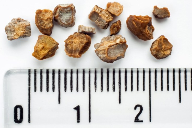 The Ultimate Eating Plan That Prevents Kidney&nbsp;Stones